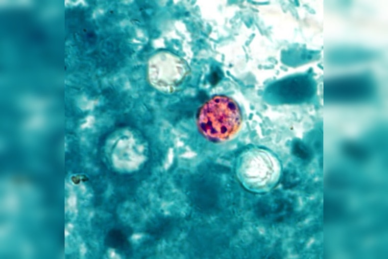 Oahu Resident Becomes Hawaii's First Locally Acquired Cyclospora Case