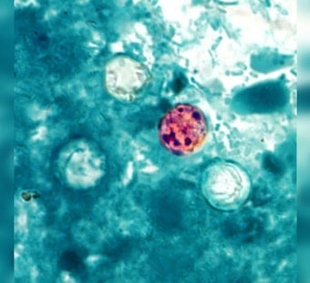 Oahu Resident Becomes Hawaii's First Locally Acquired Cyclospora Case