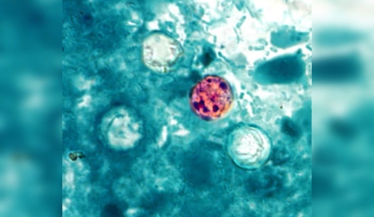 Oahu Resident Becomes Hawaii's First Locally Acquired Cyclospora Case