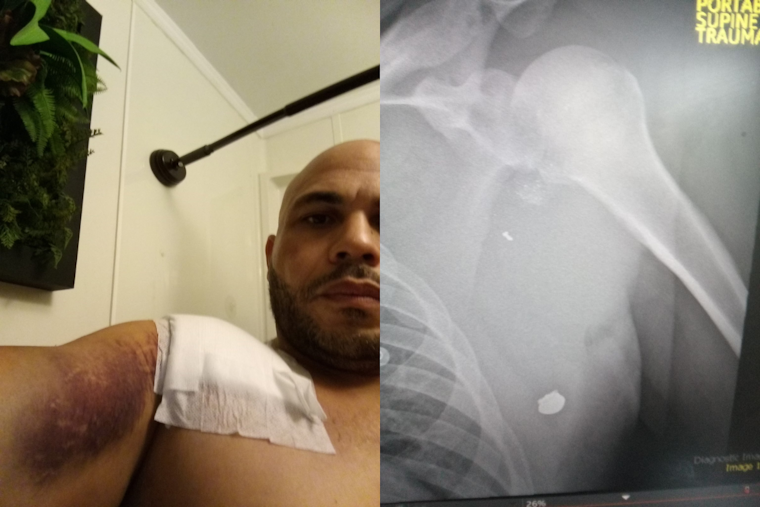 Portland Man Shot Breaking Up Fight Says He Thought of His Kids as He Fell