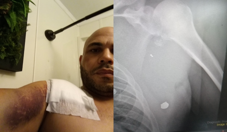 Portland Man Shot Breaking Up Fight Says He Thought of His Kids as He Fell