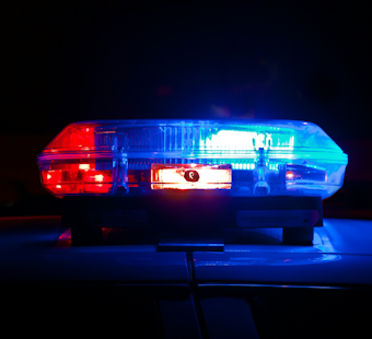 Rancho Bernardo E-Bike Fork Snaps Mid-Ride, Rider Suffers Scalp-Degloving Injury