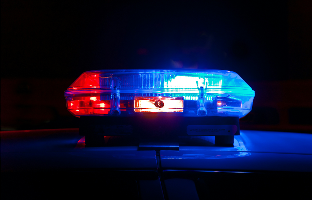 Rancho Bernardo E-Bike Fork Snaps Mid-Ride, Rider Suffers Scalp-Degloving Injury