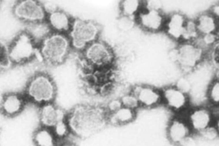 Rare La Crosse Virus Case Confirmed In East Tennessee