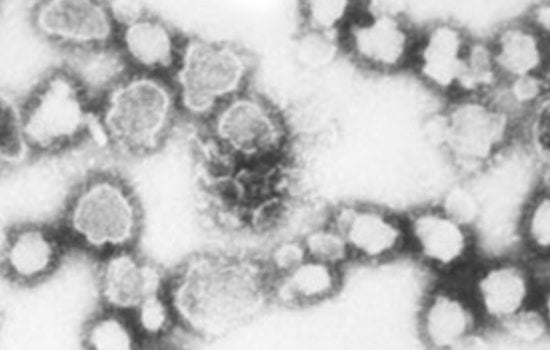 Rare La Crosse Virus Case Confirmed In East Tennessee