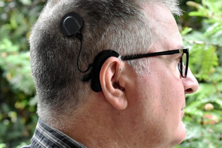 Sacramento Woman Stays Awake for Cochlear Implant Surgery, Listens to Chopin