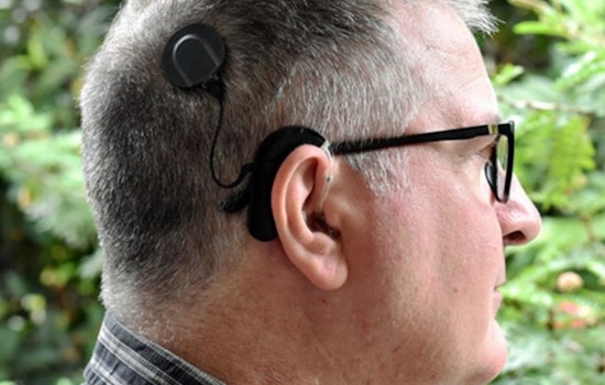 Sacramento Woman Stays Awake for Cochlear Implant Surgery, Listens to Chopin