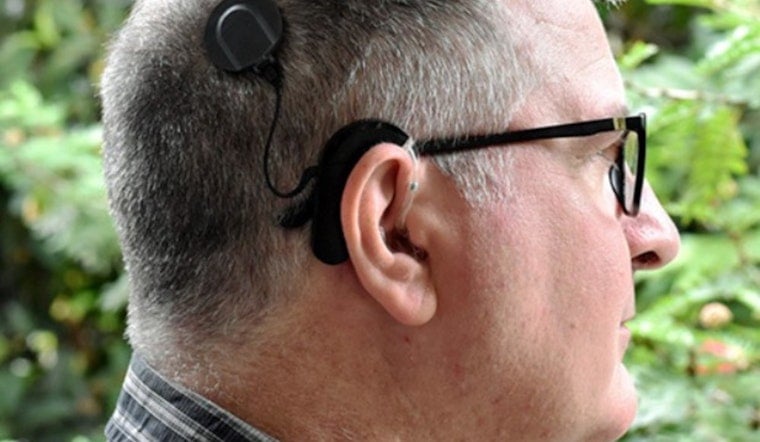 Sacramento Woman Stays Awake for Cochlear Implant Surgery, Listens to Chopin