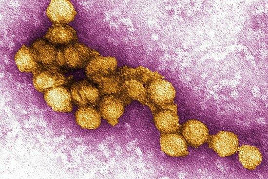 Suburban Cook County Confirms First 4 West Nile Cases as Officials Warn Risk Is High