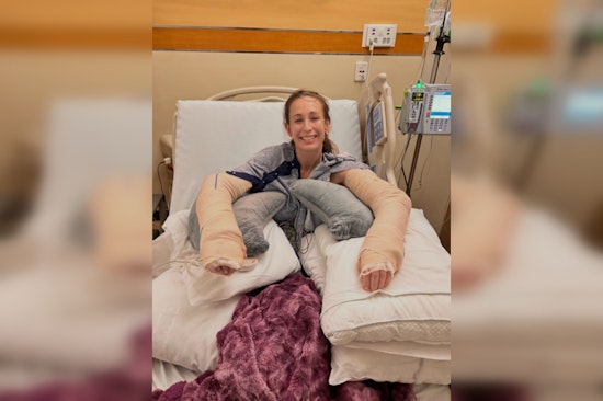 Tempe Foster Volunteer Nearly Loses Arm Breaking Up Attack by Rescued Dog