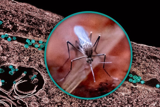 Wayne County Reports First Human West Nile Case, Suburban Resident Infected