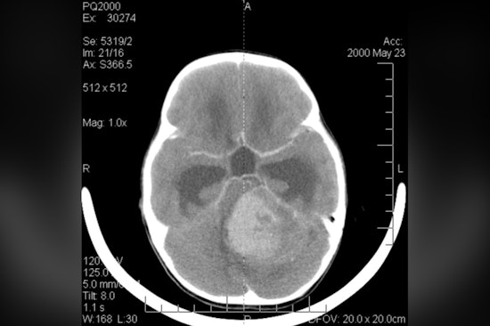 Westchester Teen Who Lost His Voice to Brain Cancer Finds It Again Through AI Music