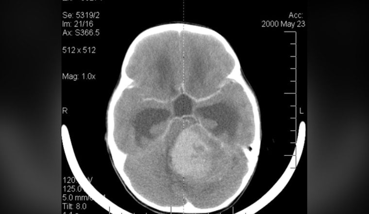 Westchester Teen Who Lost His Voice to Brain Cancer Finds It Again Through AI Music