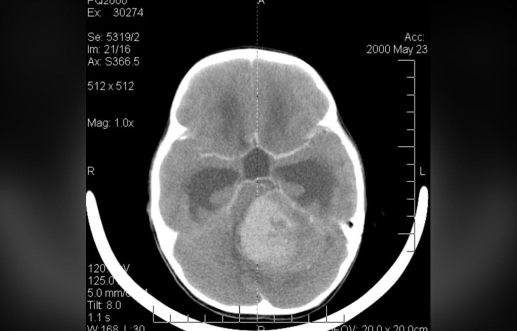 Westchester Teen Who Lost His Voice to Brain Cancer Finds It Again Through AI Music