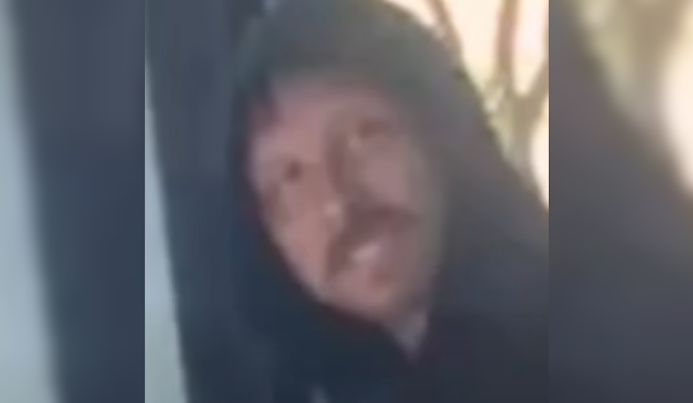 Santa Ana Police Hunt Skateboard Attacker Who Knocked Out 71-Year-Old at Bus Stop