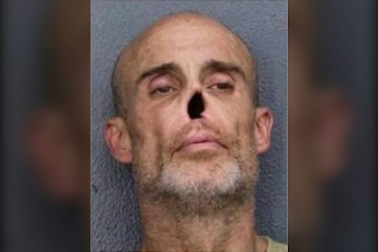 Brooklyn Man With Hole Where Nose Should Be Busted In Fort Lauderdale Drug Stop