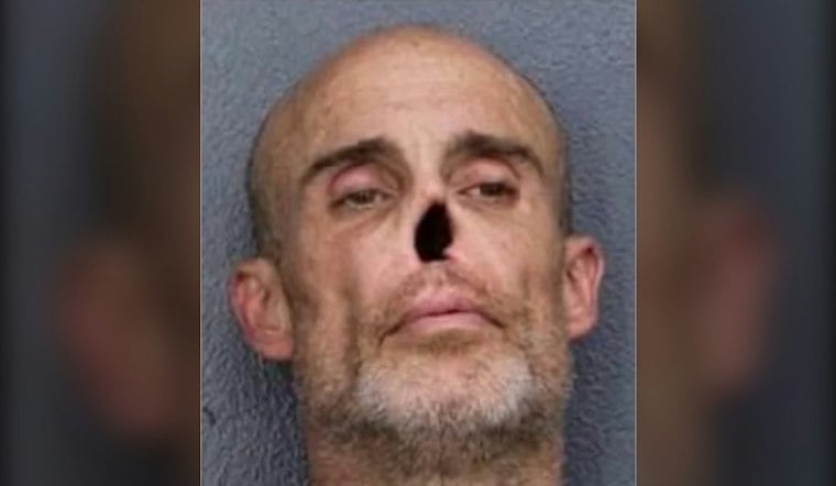 Brooklyn Man With Hole Where Nose Should Be Busted In Fort Lauderdale Drug Stop
