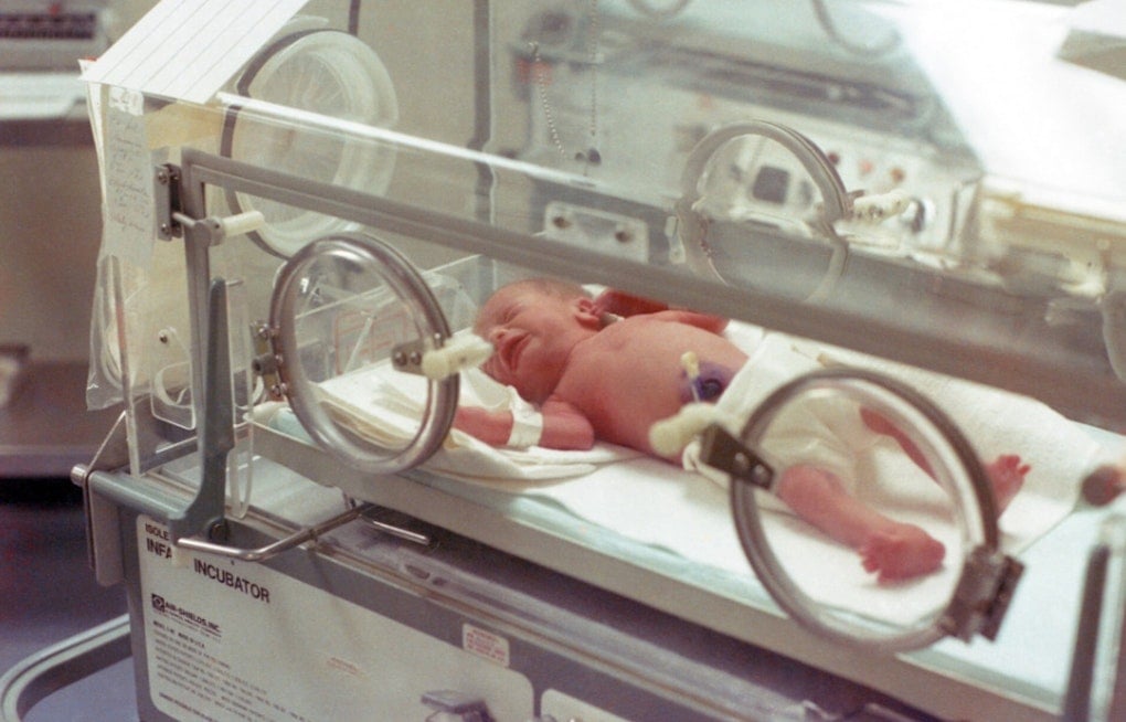 Chapel Hill NICU Sends Baby Janouri Home After Monthslong Airway Battle