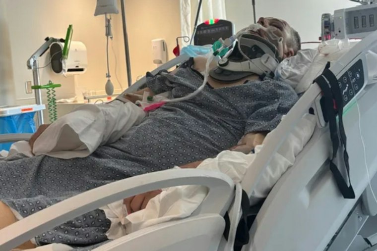 Gwinnett Scooter Rider In Coma After Driver Admits Passing on Wrong Side