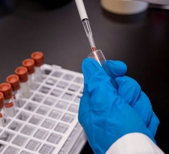 Louisiana Act Creates State Review System for University Research Ties