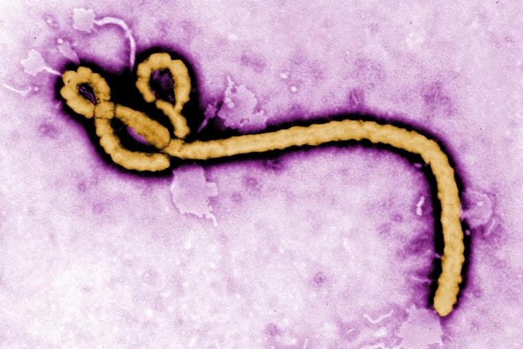 Melbourne Surgeon's Kenya Mission Delivers 27 New Joints, Faces Ebola Concern