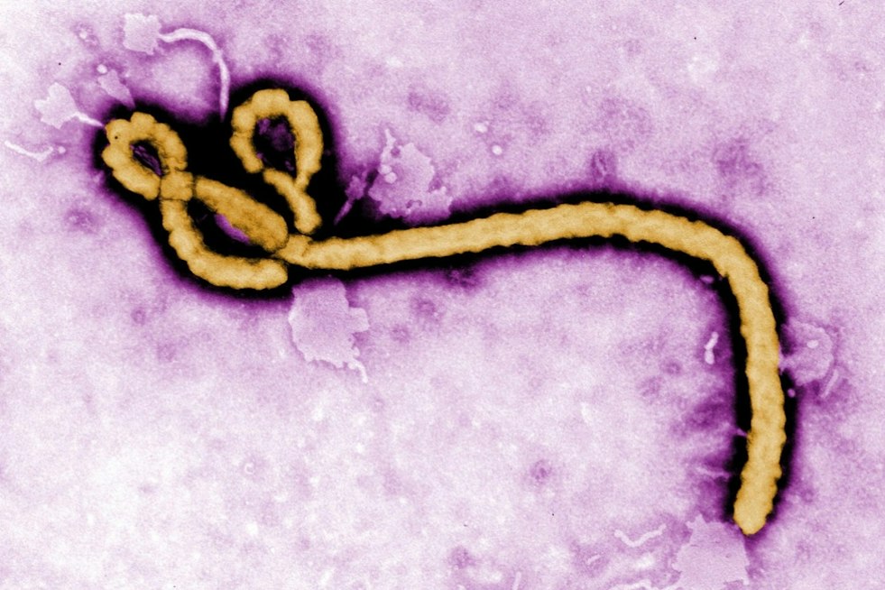 Melbourne Surgeon's Kenya Mission Delivers 27 New Joints, Faces Ebola Concern