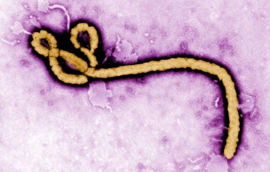 Melbourne Surgeon's Kenya Mission Delivers 27 New Joints, Faces Ebola Concern
