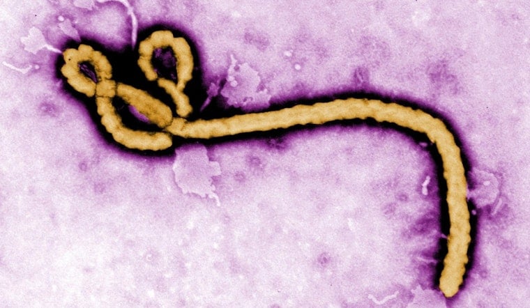 Melbourne Surgeon's Kenya Mission Delivers 27 New Joints, Faces Ebola Concern