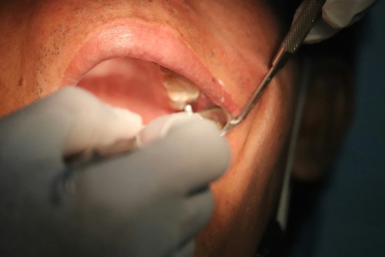 Menlo Park VC Doug Leone Skipped Novocaine to Prove He's a Badass