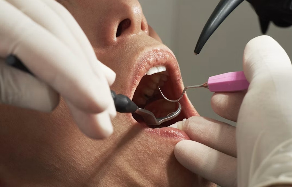 Milpitas Teen's Nonprofit Hits $100K in Free Dental Care for Veterans