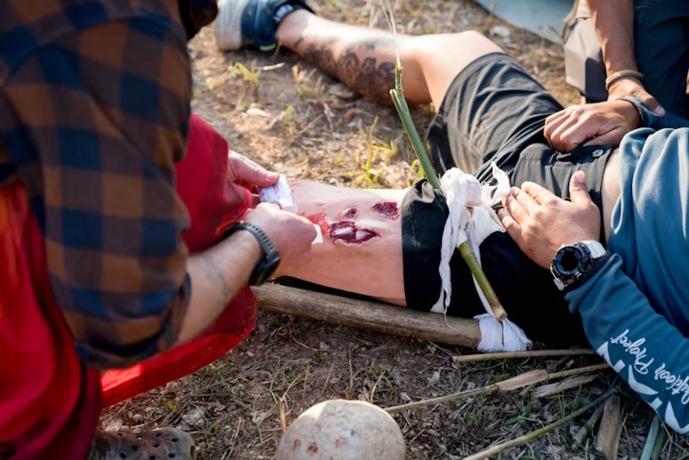 Shot 12 Times in Fountain Square Attack, Cincinnati Survivor Teaches Bleeding Control 8 Years Later