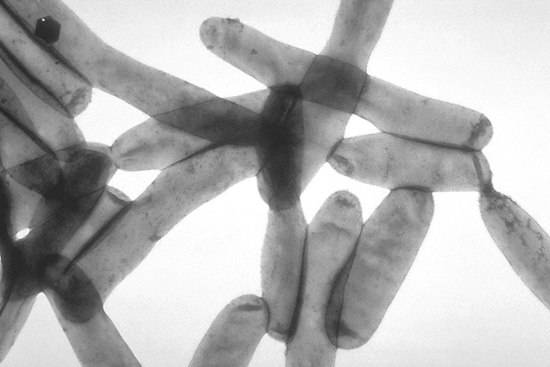 South Bronx Legionnaires Cluster Kills One, Sickens Five in Melrose and Morrisania