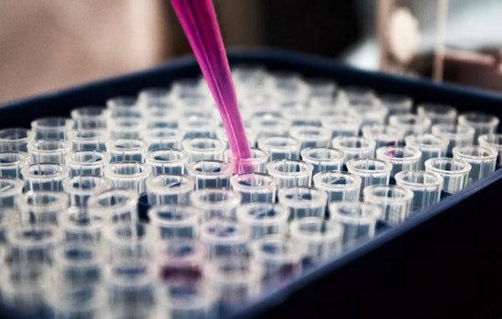South Lake Union Lab Bets $95M That AI Can Design New Proteins Fast