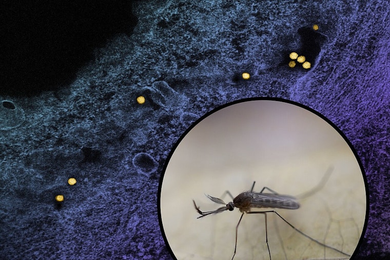 Two Aurora Residents Hospitalized With Severe West Nile Virus in Kane County