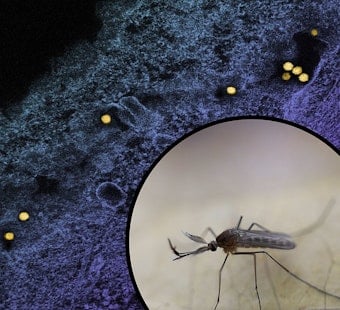 Two Aurora Residents Hospitalized With Severe West Nile Virus in Kane County