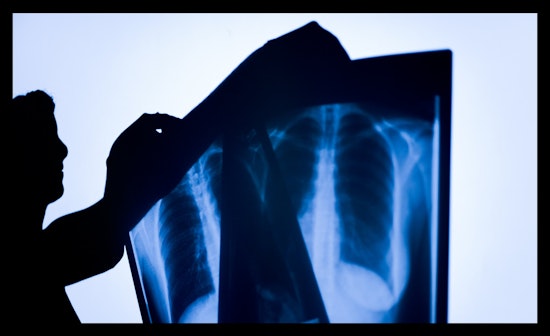 Jobs report: Philly tops nationwide hiring for radiologists and more