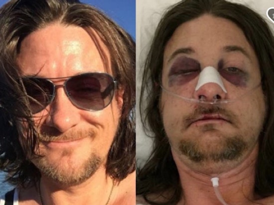 Badlands Employee Brutally Attacked Outside The Cafe In Possible 'Gay Bashing' Incident [Updated]