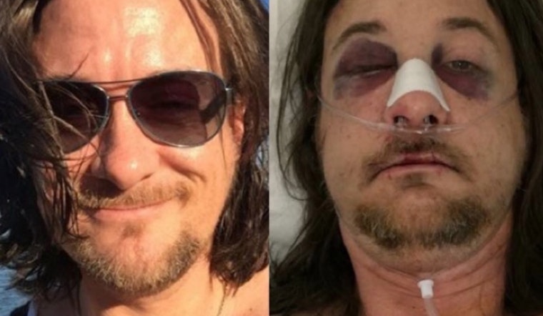 Badlands Employee Brutally Attacked Outside The Cafe In Possible 'Gay Bashing' Incident [Updated]