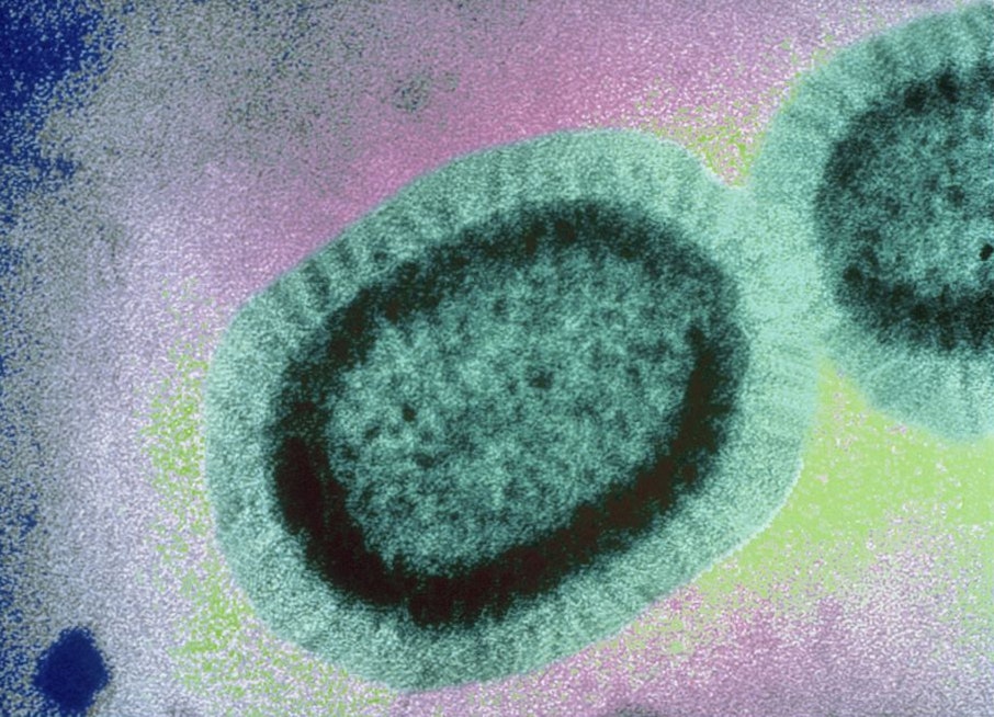City warns of active measles patient who rode Muni, Caltrain; visited Hayes Valley businesses