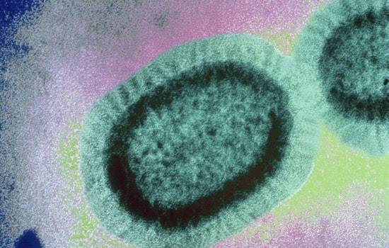 City warns of active measles patient who rode Muni, Caltrain; visited Hayes Valley businesses