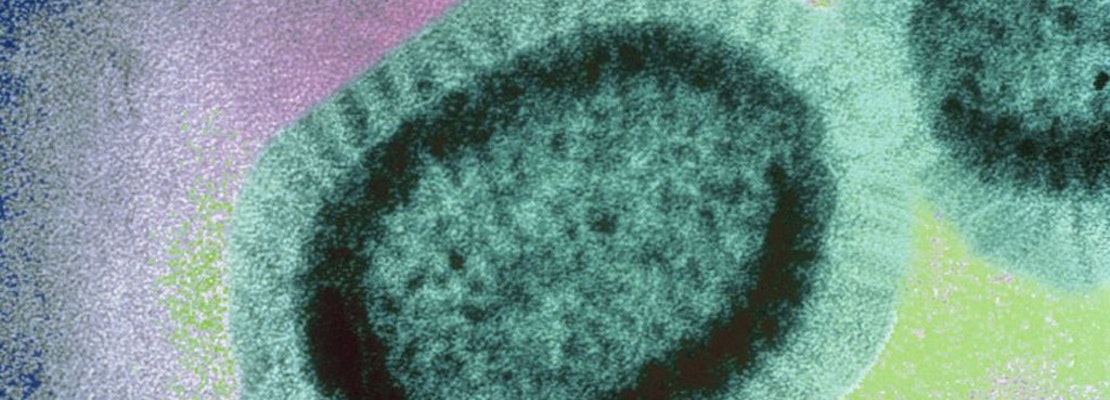 City warns of active measles patient who rode Muni, Caltrain; visited Hayes Valley businesses