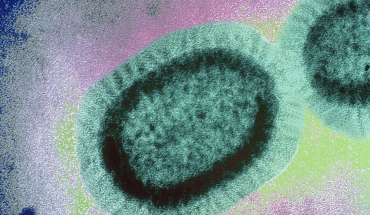 City warns of active measles patient who rode Muni, Caltrain; visited Hayes Valley businesses
