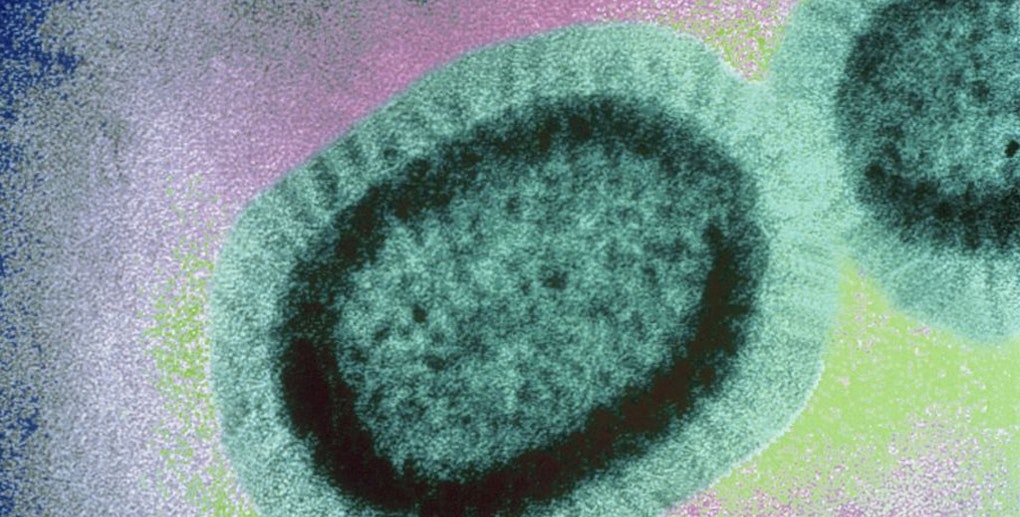 City warns of active measles patient who rode Muni, Caltrain; visited Hayes Valley businesses