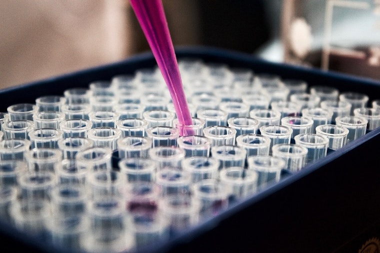 Agilvax and Robotic Skies top Albuquerque's recent funding news