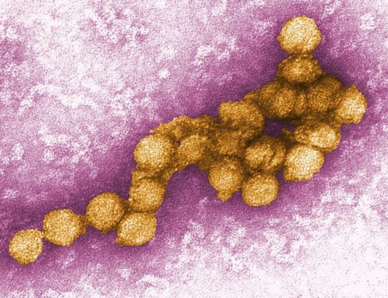 Top Fresno news: Woman hospitalized, infected with West Nile Virus; serial rapist denied parole