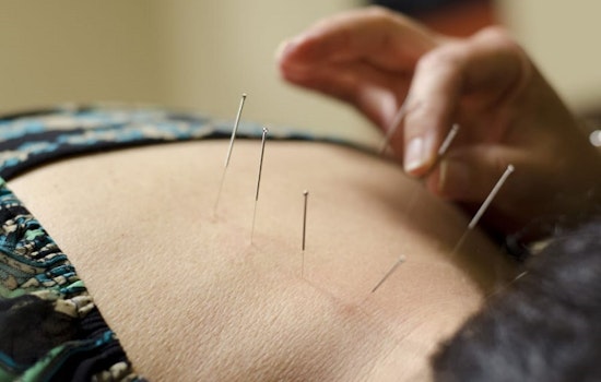 Here are Mesa's top 5 acupuncture spots