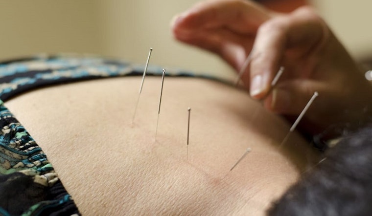 Here are Mesa's top 5 acupuncture spots