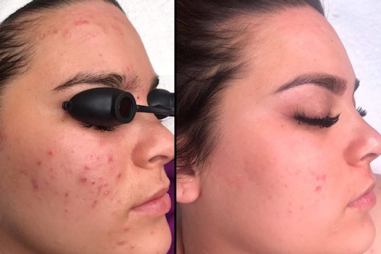 The 4 best skin care spots in Chula Vista