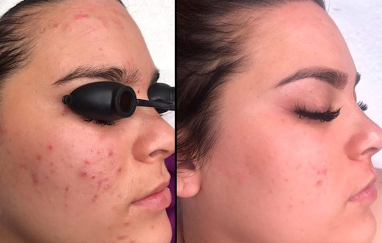 The 4 best skin care spots in Chula Vista