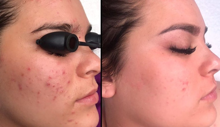 The 4 best skin care spots in Chula Vista